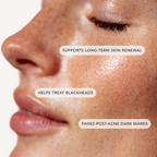 Blemish Control AHA 20%