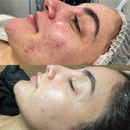 Problematic Skin Pack