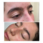 Problematic Skin Pack